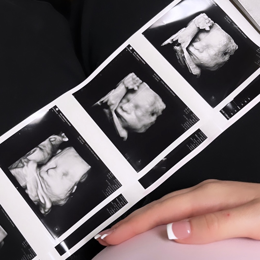 Photo shared by Makayla for their Babylist baby registry.