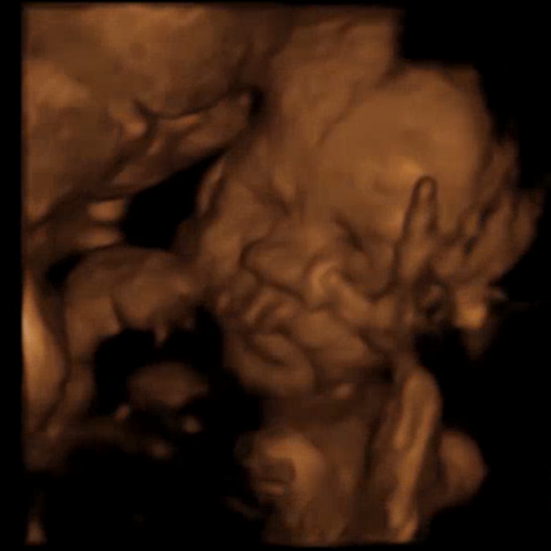 Photo shared by McKenzie for their Babylist baby registry.