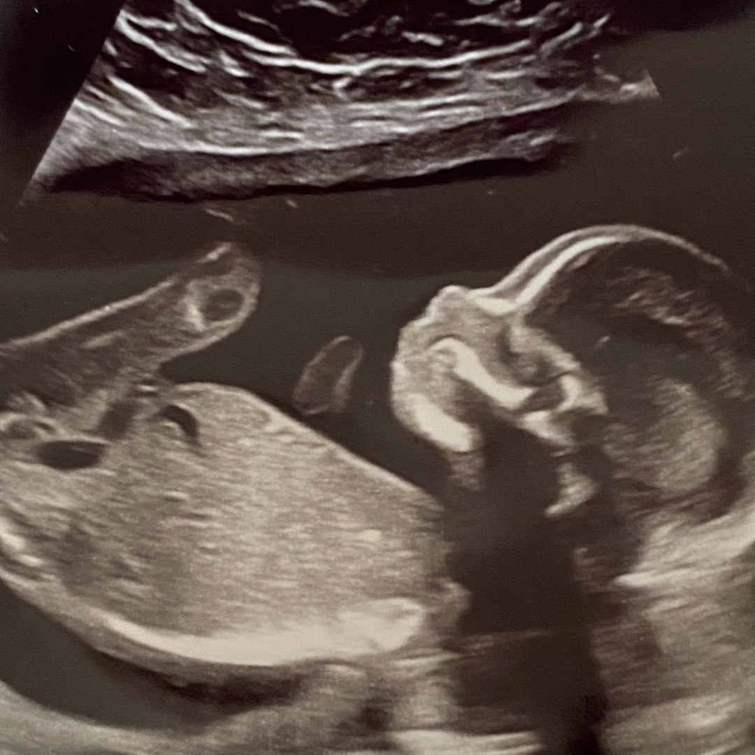 Photo shared by Jacqueline for their Babylist baby registry.