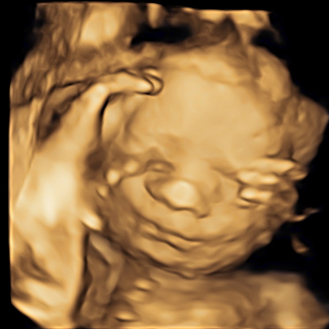 Photo shared by Carly for their Babylist baby registry.