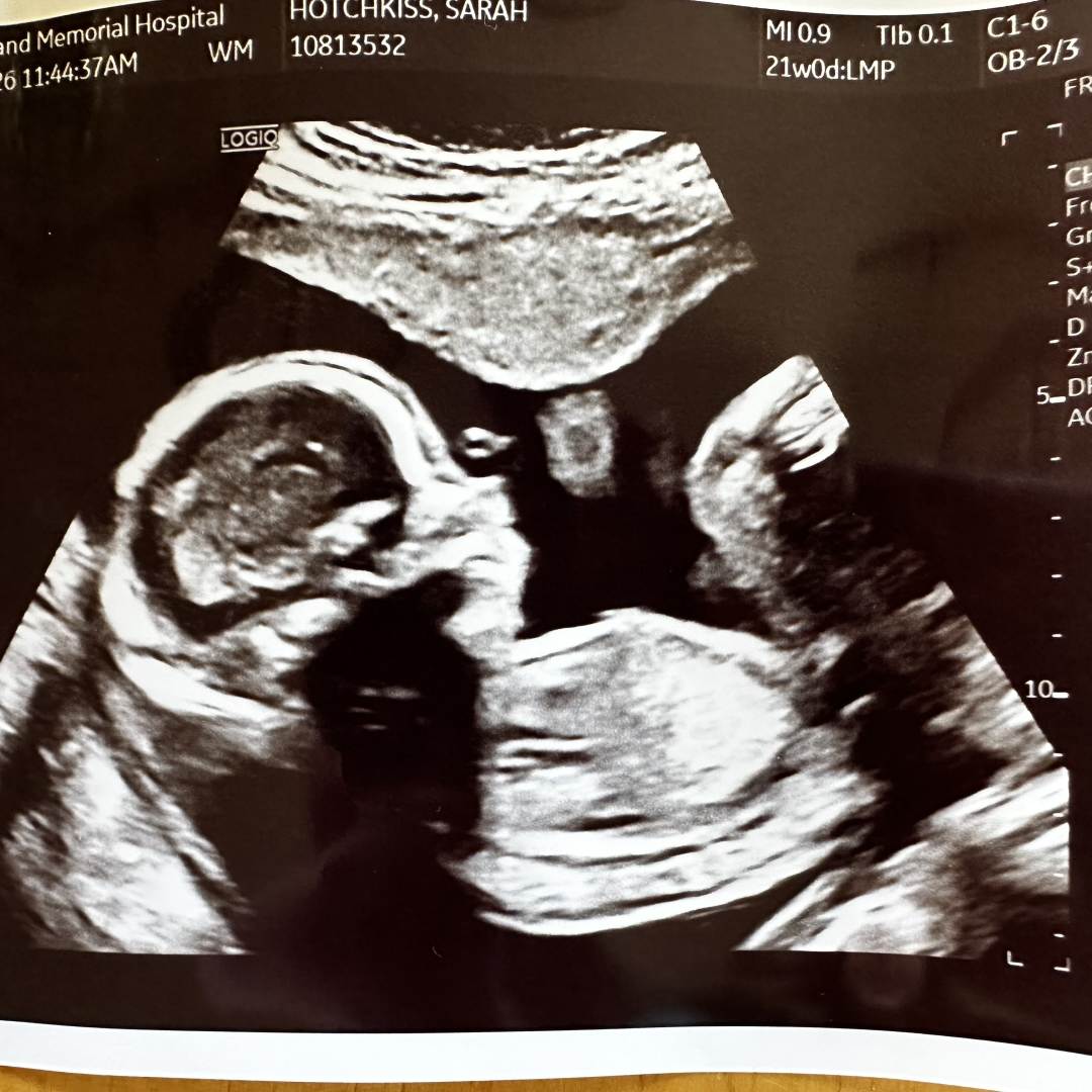 Photo shared by Sarah for their Babylist baby registry.