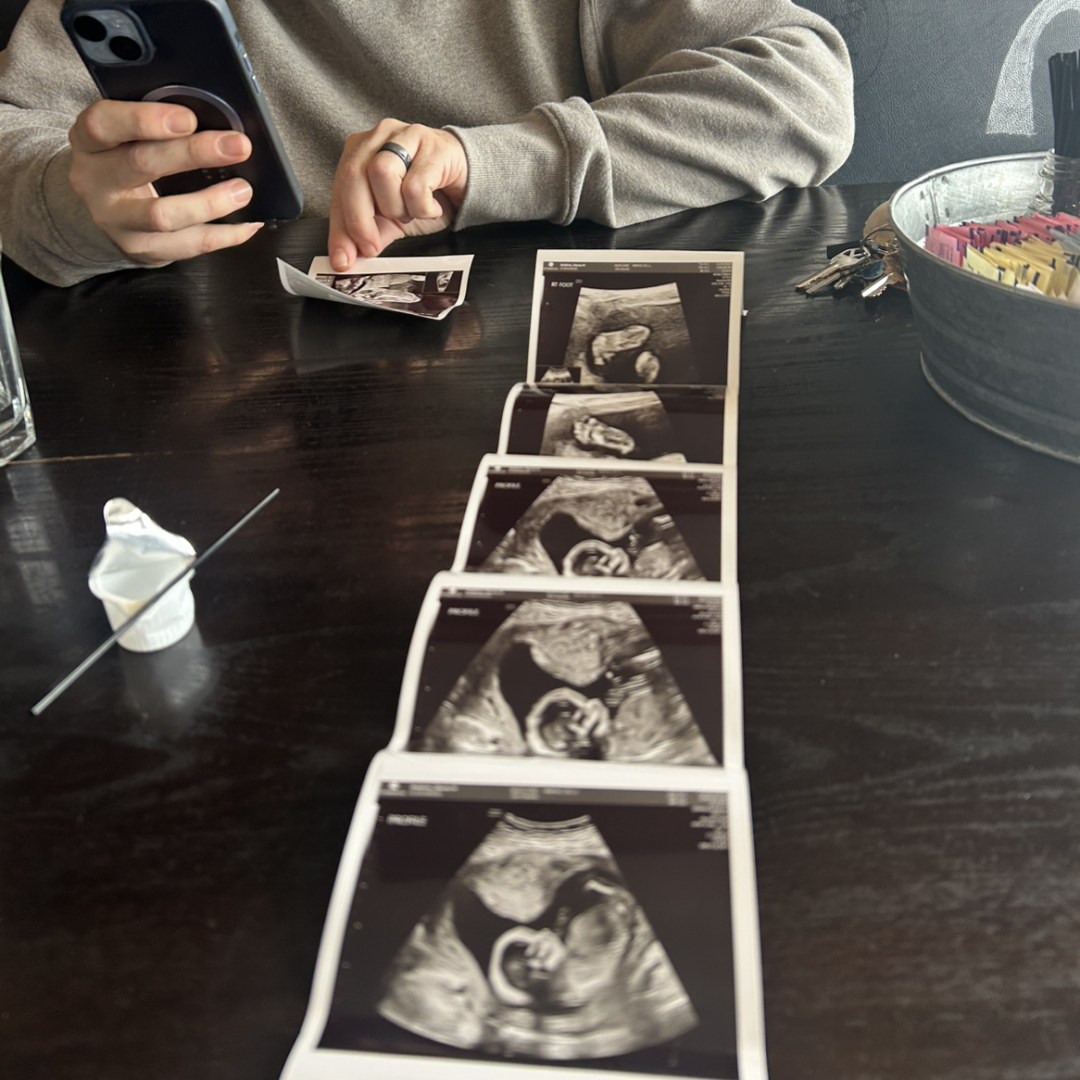 Photo shared by Stacey for their Babylist baby registry.