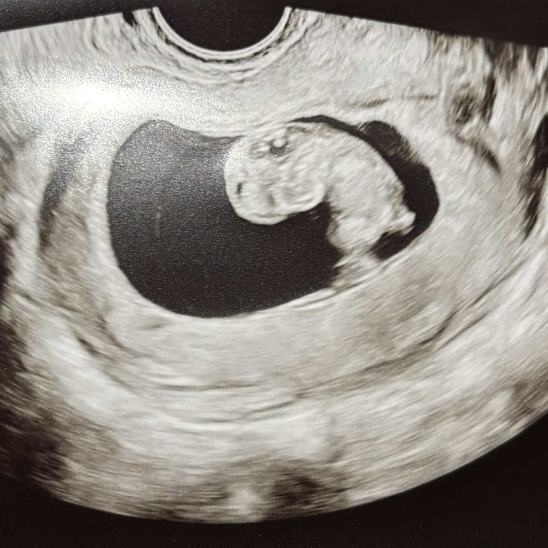 Photo shared by Caleigh for their Babylist baby registry.