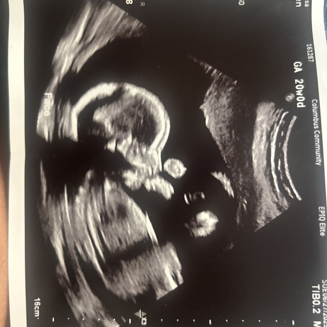 Photo shared by Tessa for their Babylist baby registry.