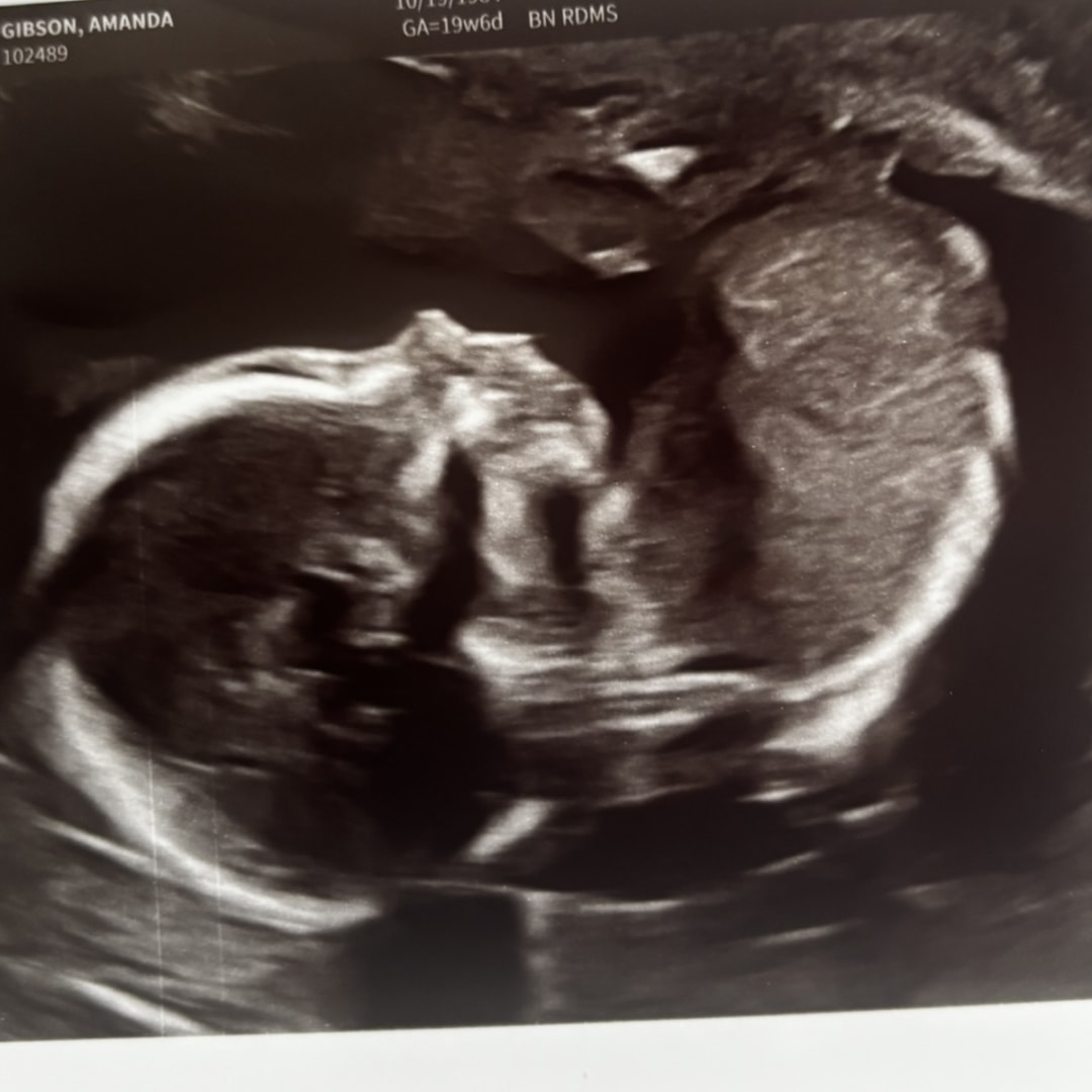 Photo shared by Amanda for their Babylist baby registry.