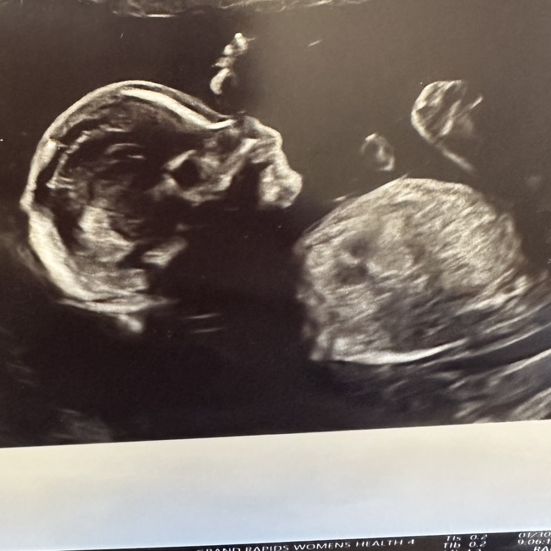 Photo shared by Taylor for their Babylist baby registry.