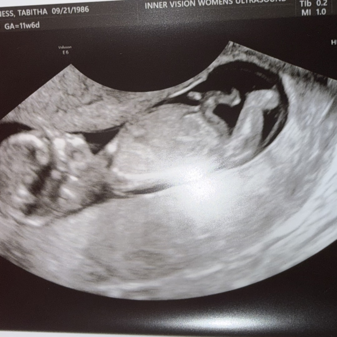 Photo shared by Tabitha for their Babylist baby registry.