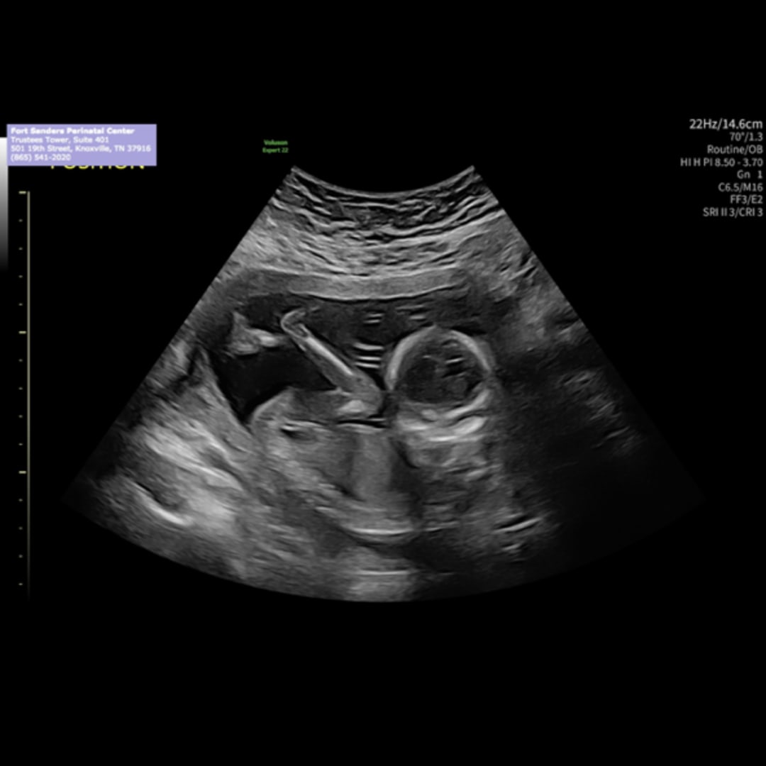 Photo shared by Allie for their Babylist baby registry.