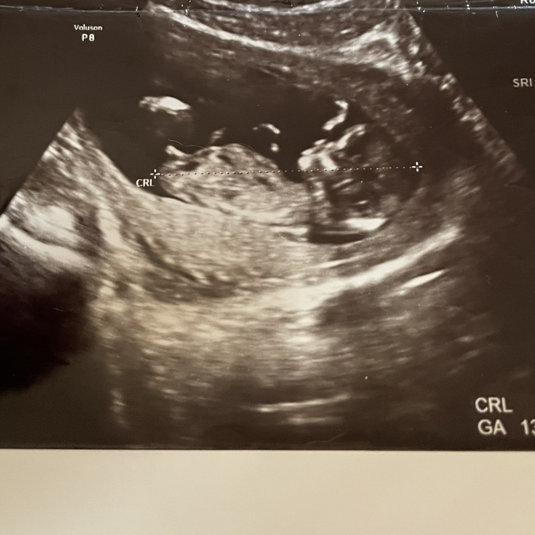 Photo shared by Jessica for their Babylist baby registry.