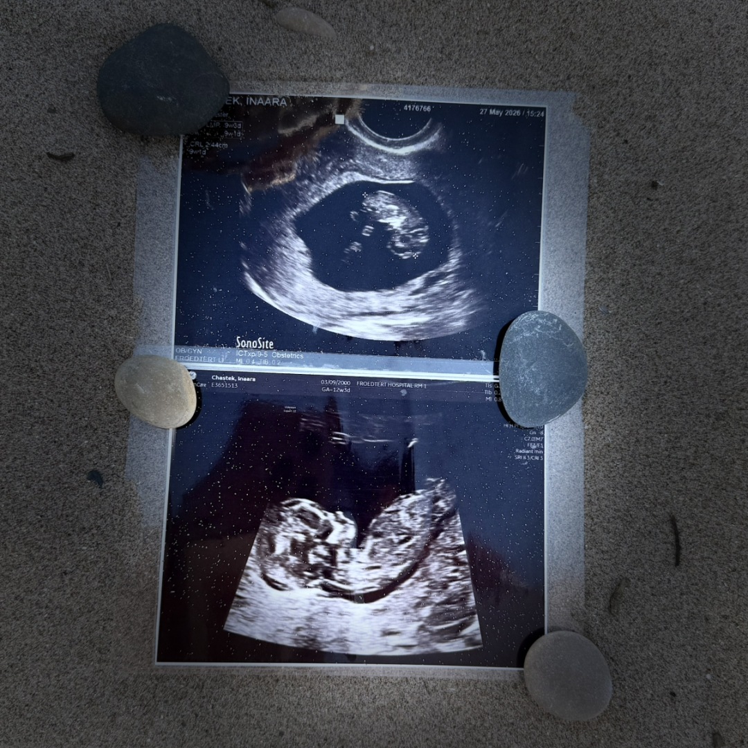 Photo shared by Inaara for their Babylist baby registry.