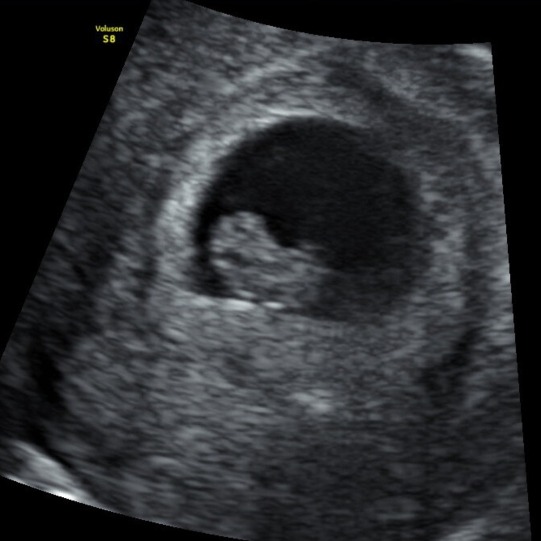 Photo shared by Felicia for their Babylist baby registry.