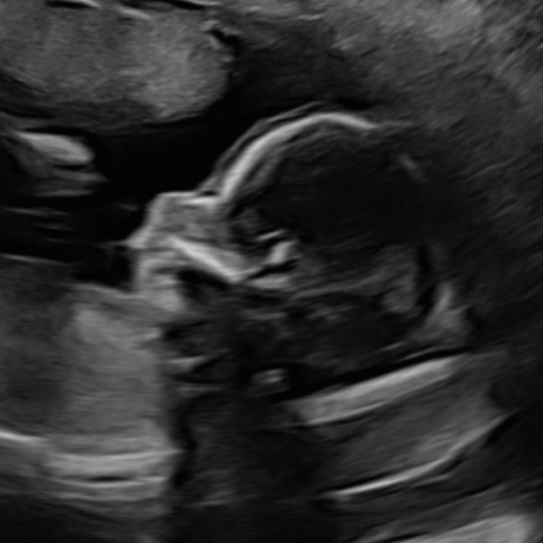 Photo shared by Breanna for their Babylist baby registry.