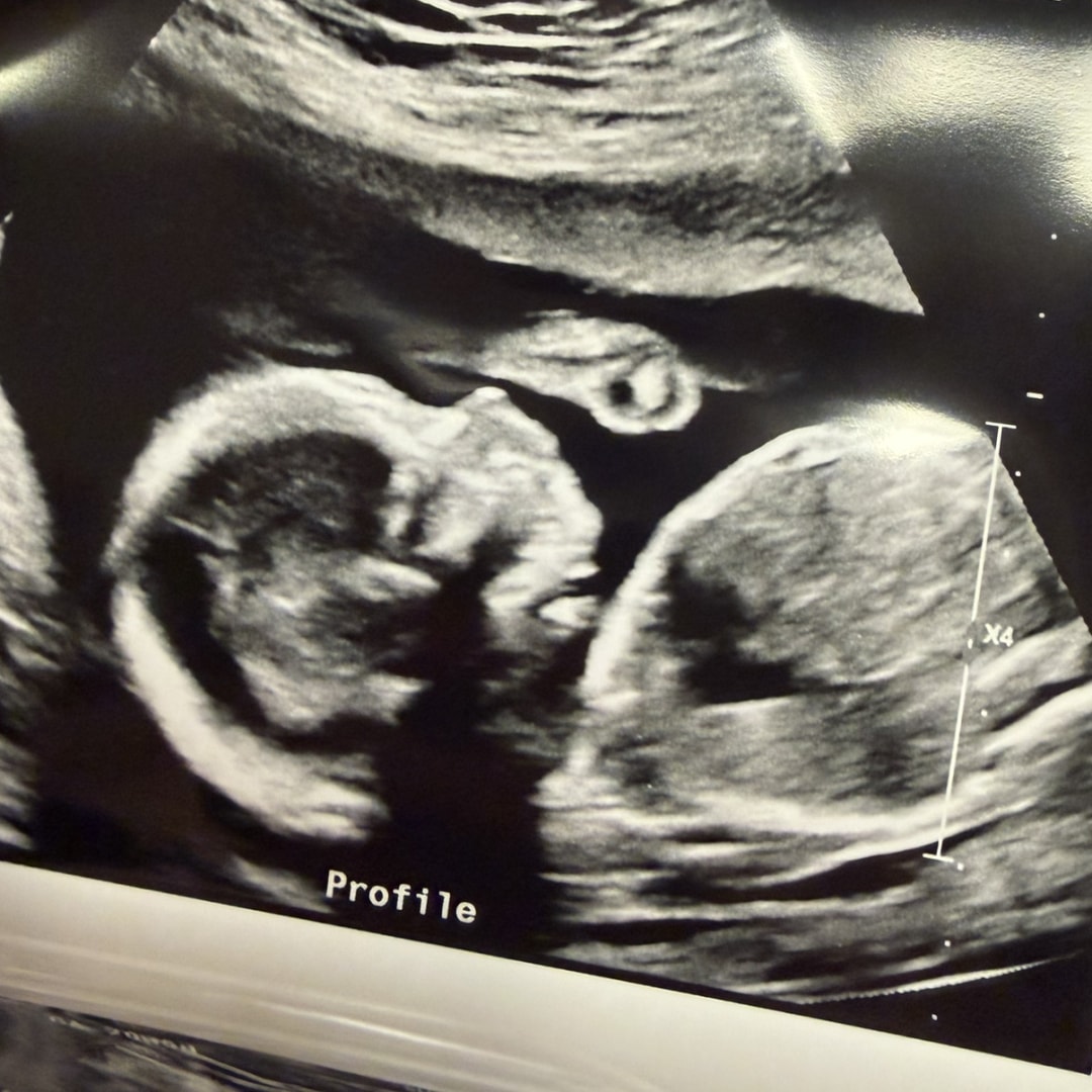 Photo shared by Ashley for their Babylist baby registry.