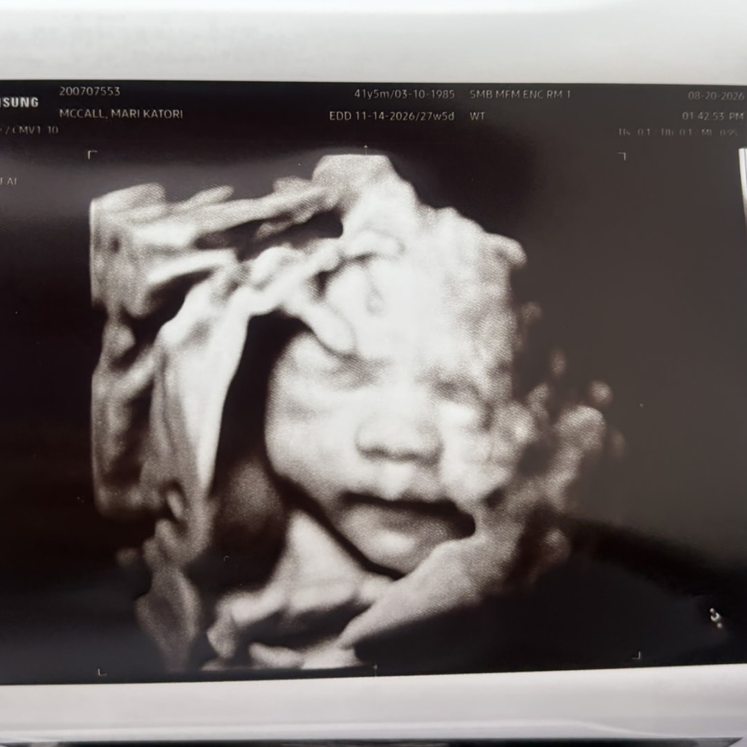 Photo shared by Mari for their Babylist baby registry.