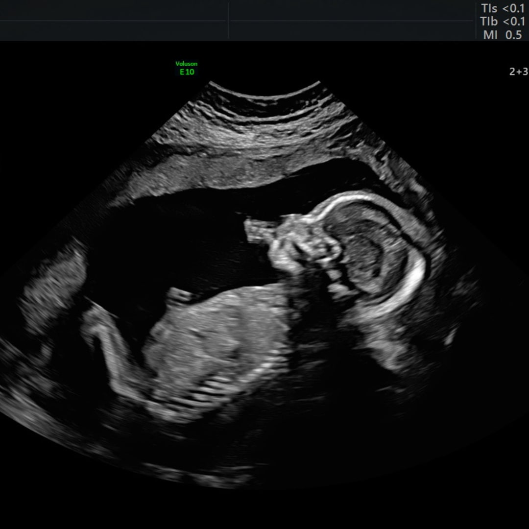 Photo shared by Emily for their Babylist baby registry.