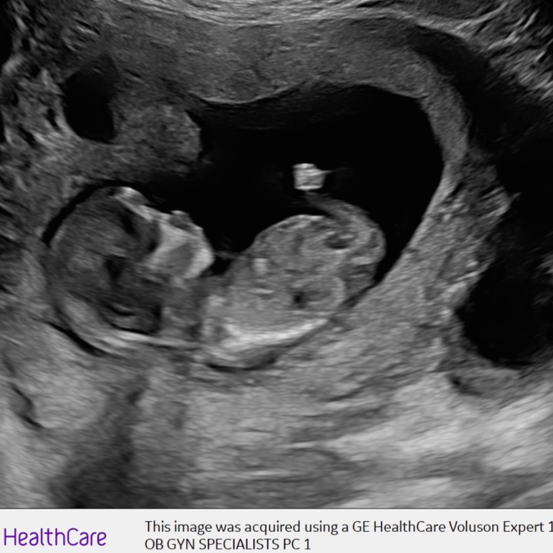 Photo shared by Sarah for their Babylist baby registry.
