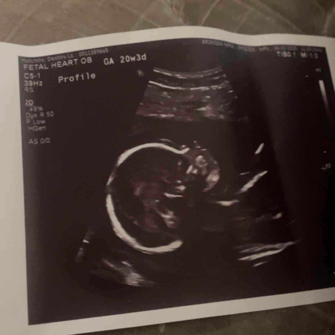Photo shared by Destiny for their Babylist baby registry.