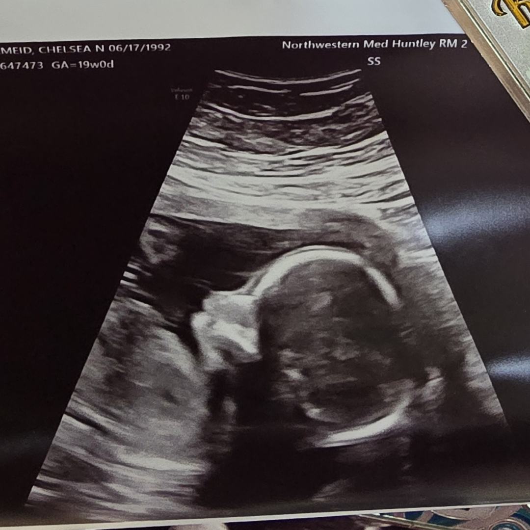Photo shared by CHELSEA for their Babylist baby registry.