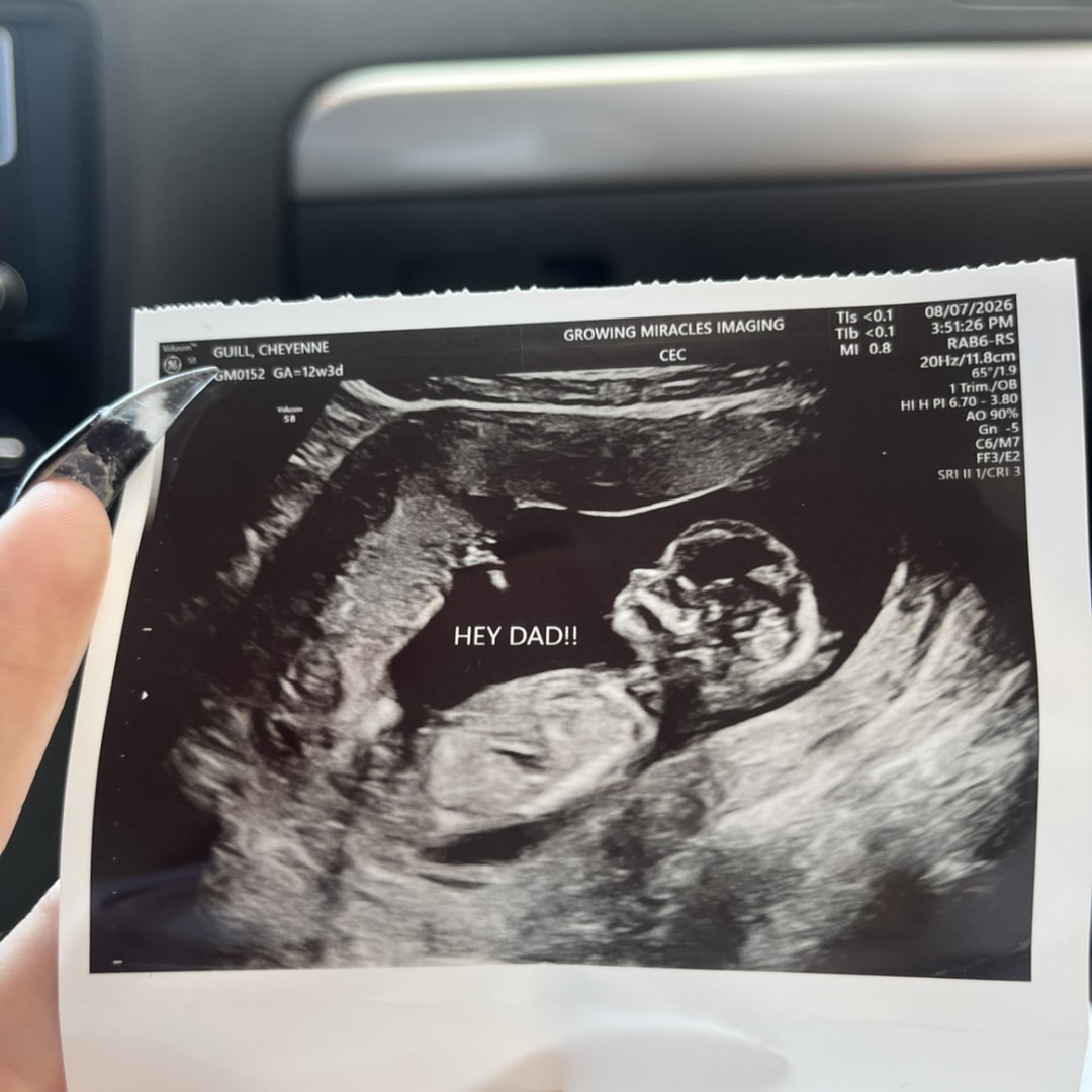 Photo shared by Bunny for their Babylist baby registry.