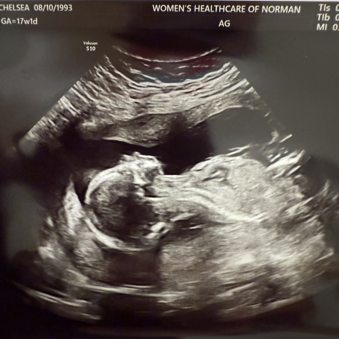 Photo shared by Chelsea for their Babylist baby registry.