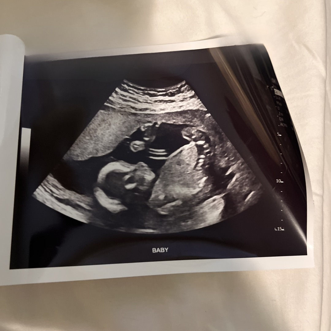 Photo shared by Stacy for their Babylist baby registry.