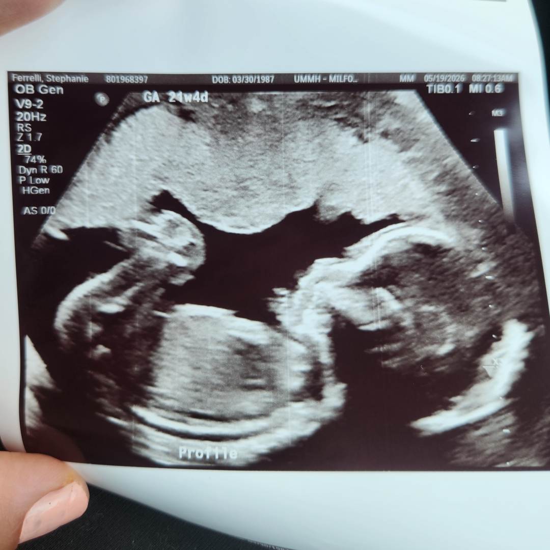 Photo shared by Stephanie for their Babylist baby registry.