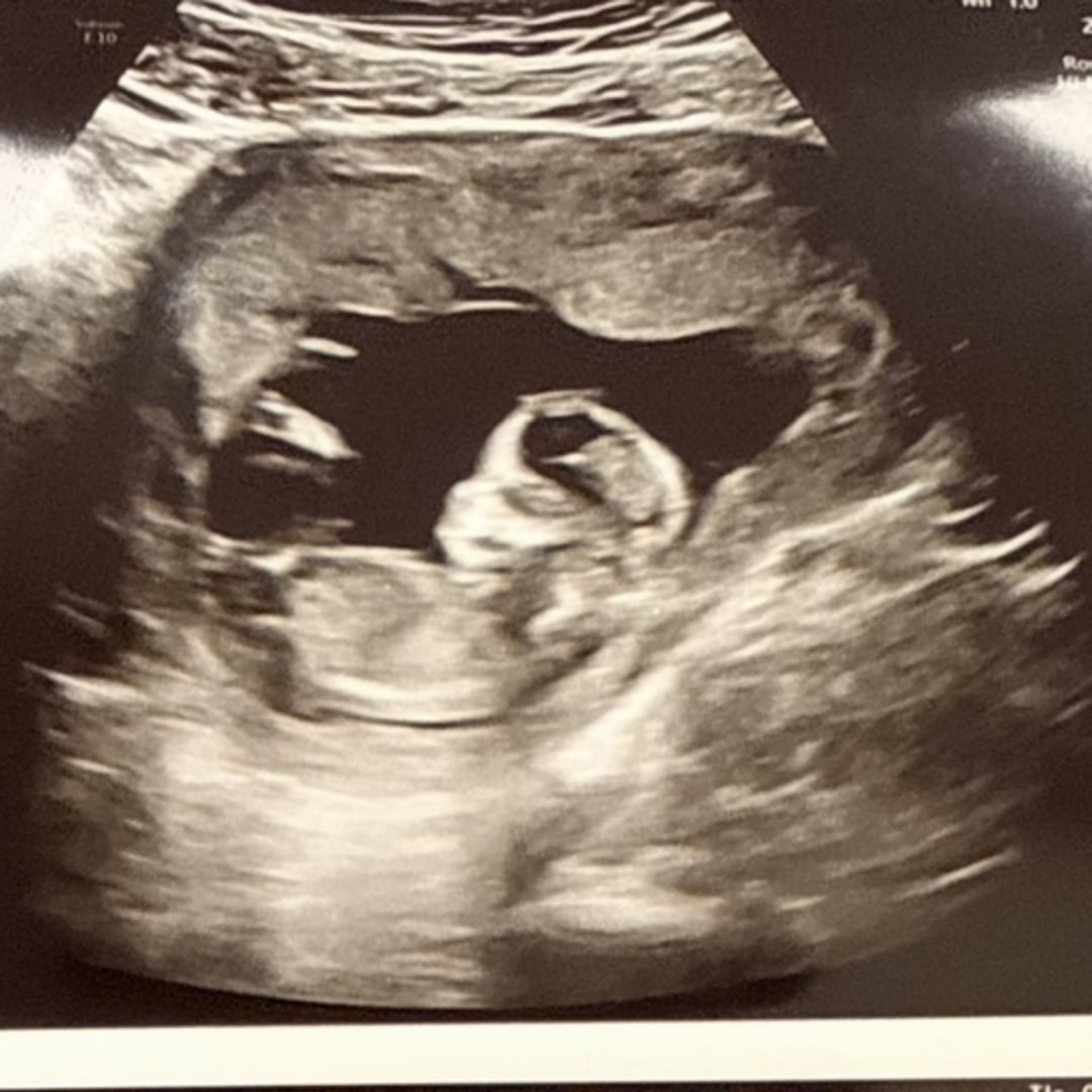 Photo shared by China for their Babylist baby registry.