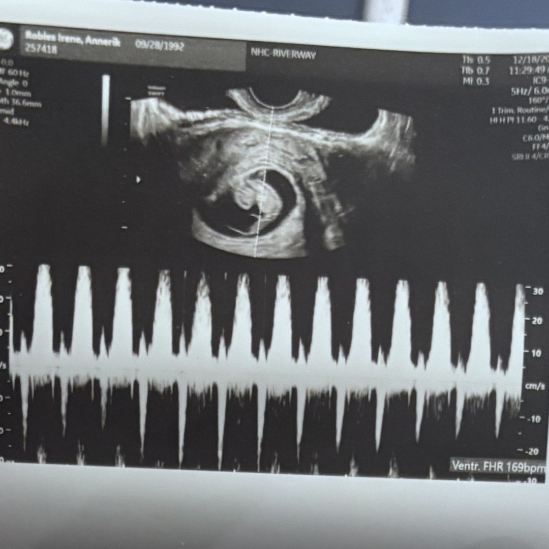 Photo shared by Annerik for their Babylist baby registry.