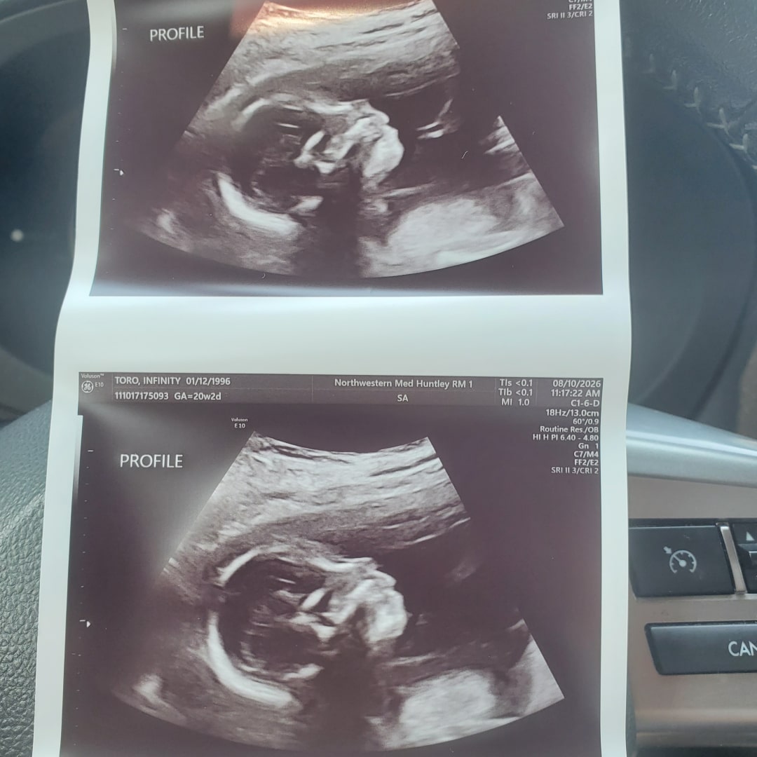 Photo shared by Infinity for their Babylist baby registry.