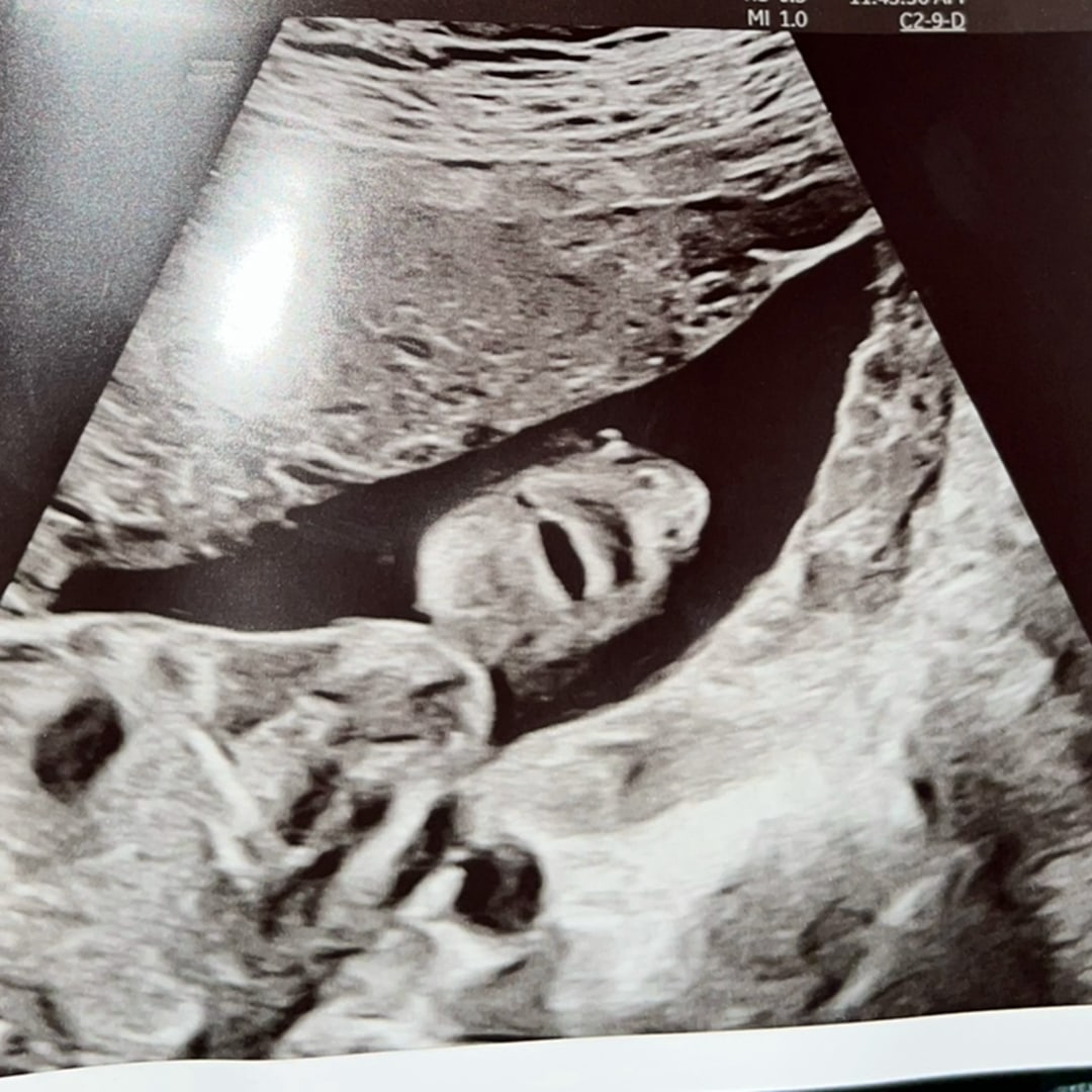 Photo shared by Elis for their Babylist baby registry.