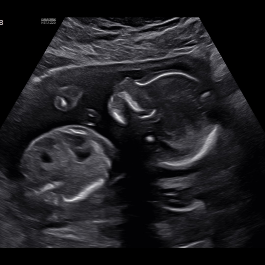 Photo shared by Megan for their Babylist baby registry.