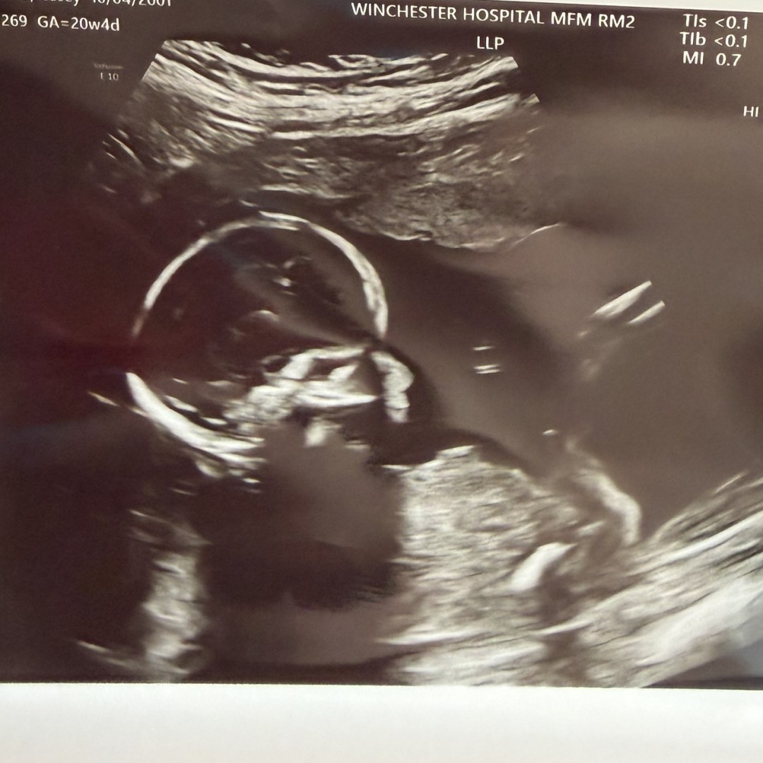 Photo shared by Casey for their Babylist baby registry.