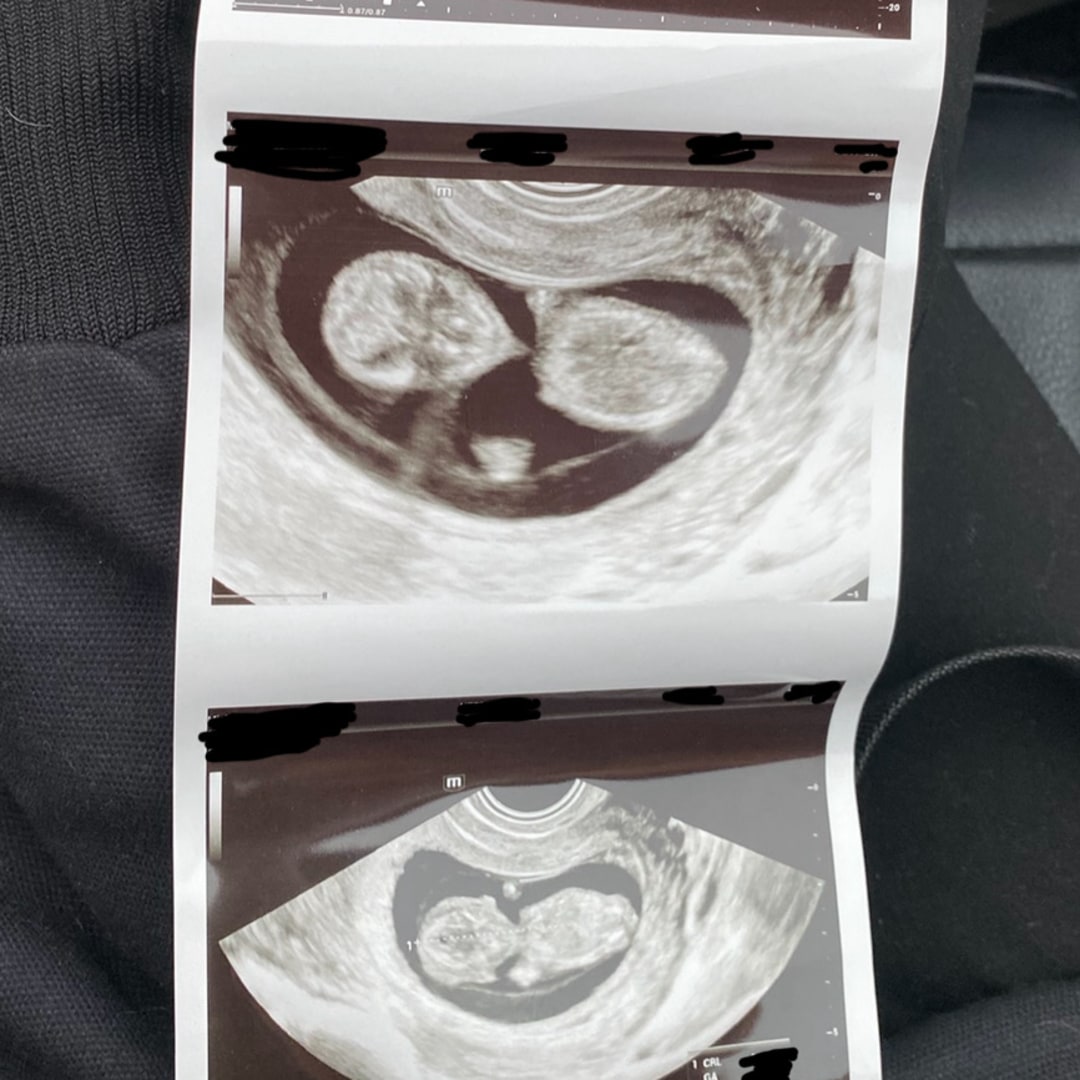 Photo shared by Paige for their Babylist baby registry.