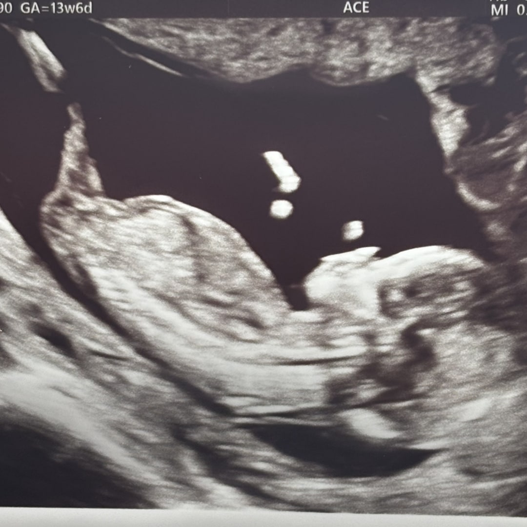 Photo shared by Teirvondria for their Babylist baby registry.