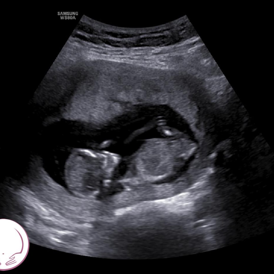 Photo shared by Maylynn for their Babylist baby registry.