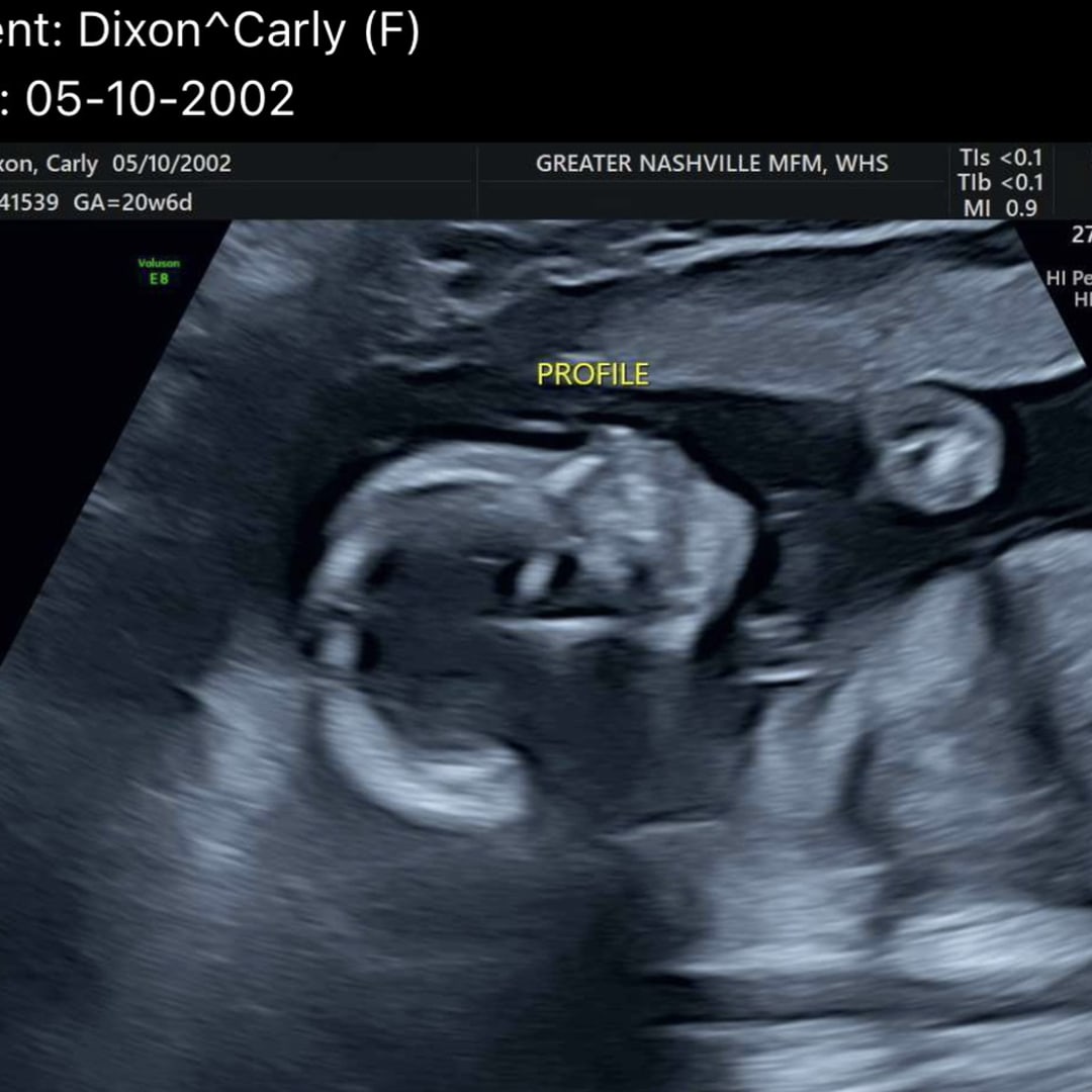 Photo shared by Carly for their Babylist baby registry.