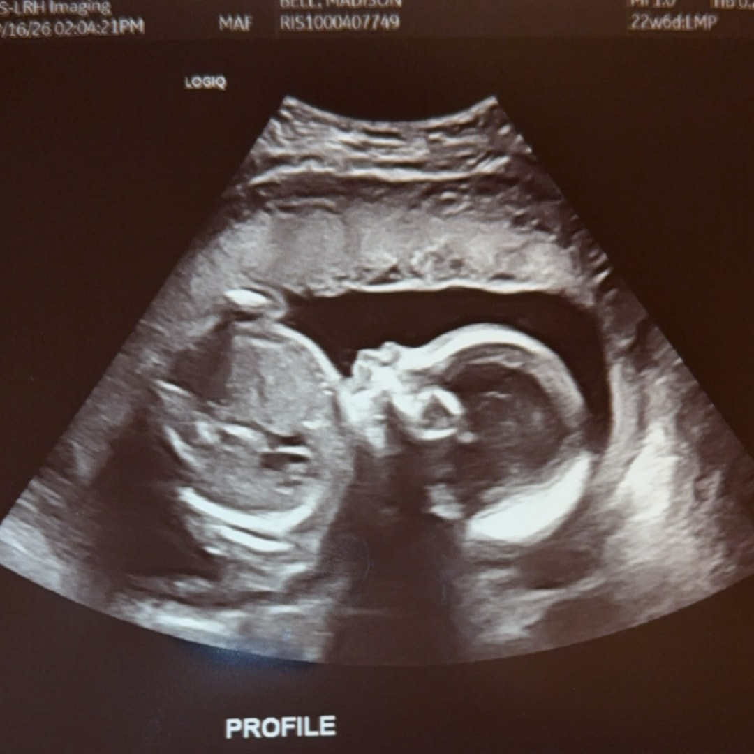 Photo shared by Madison for their Babylist baby registry.