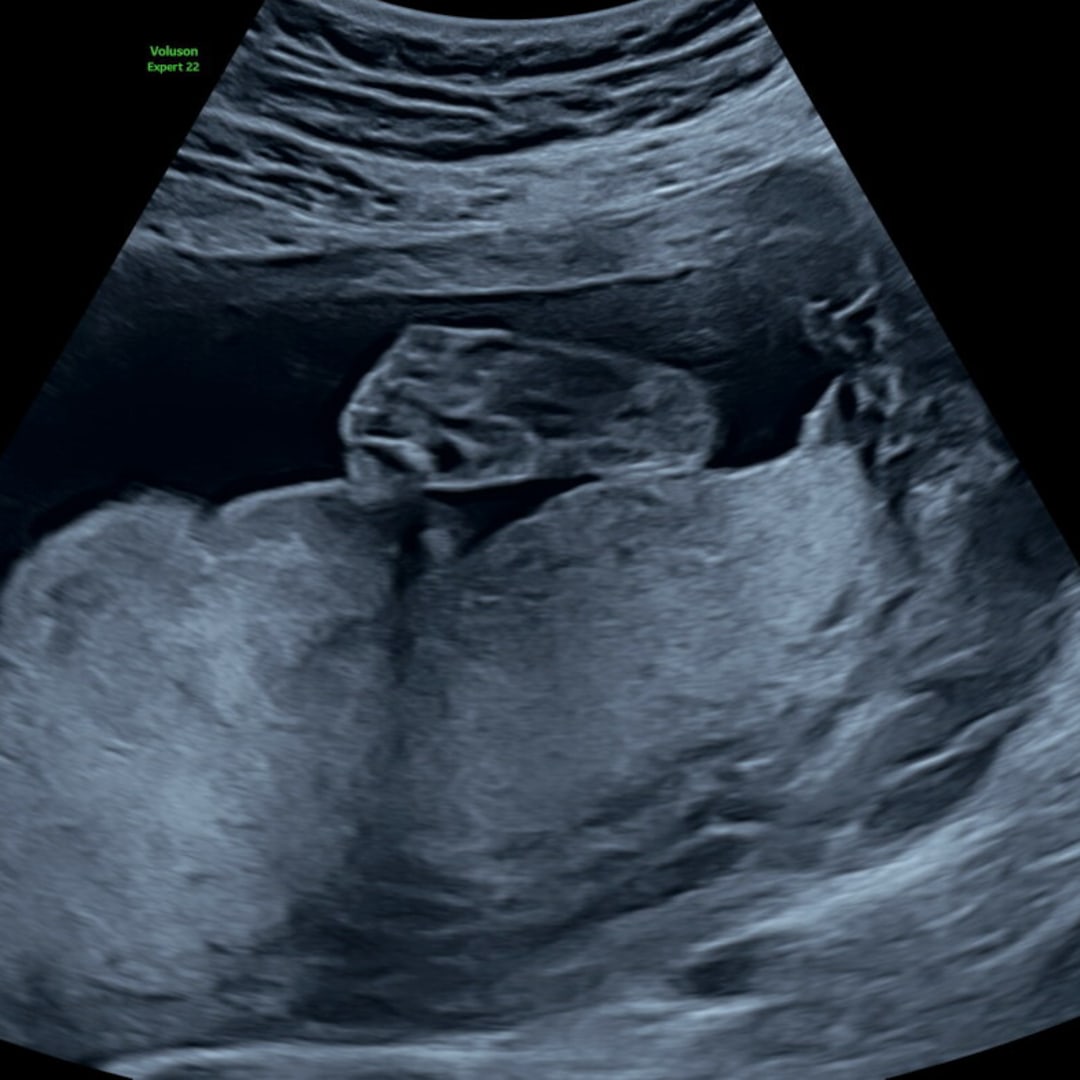 Photo shared by Erin for their Babylist baby registry.