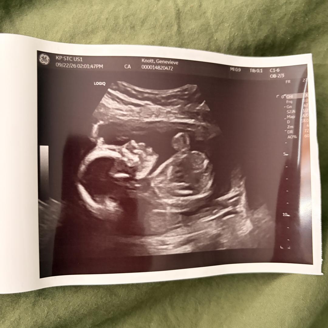 Photo shared by Genevieve for their Babylist baby registry.