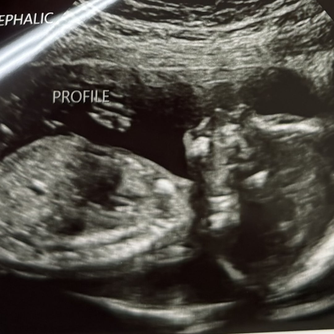 Photo shared by Alma for their Babylist baby registry.