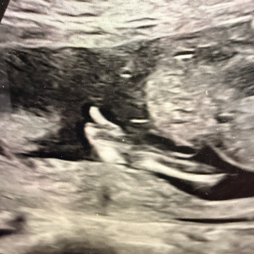 Photo shared by Abbie for their Babylist baby registry.