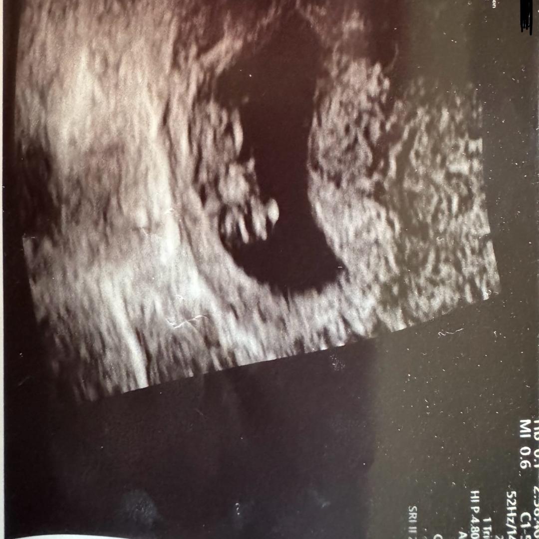 Photo shared by Katrina for their Babylist baby registry.