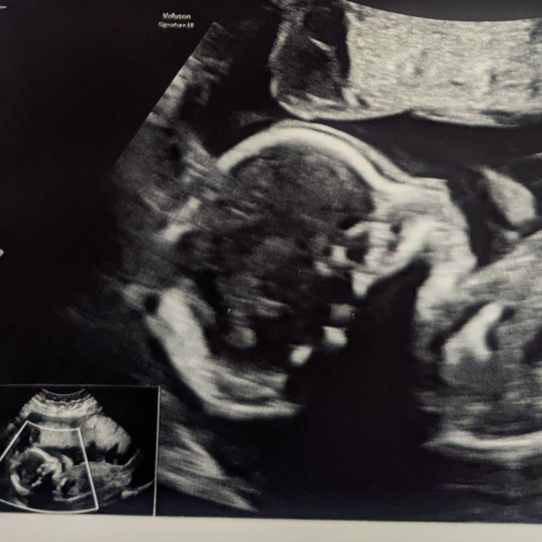 Photo shared by Elijah for their Babylist baby registry.