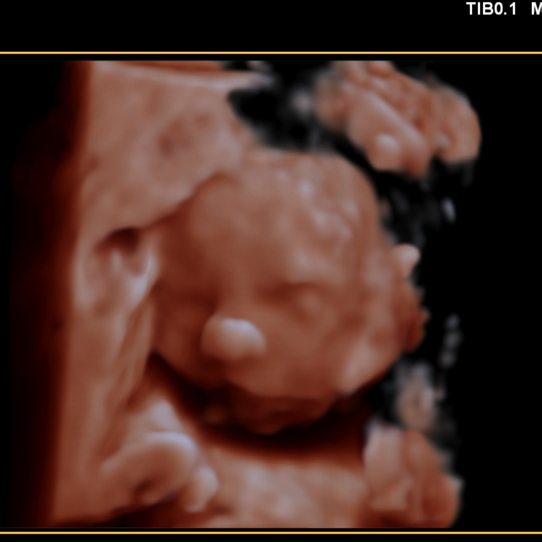 Photo shared by Hope for their Babylist baby registry.