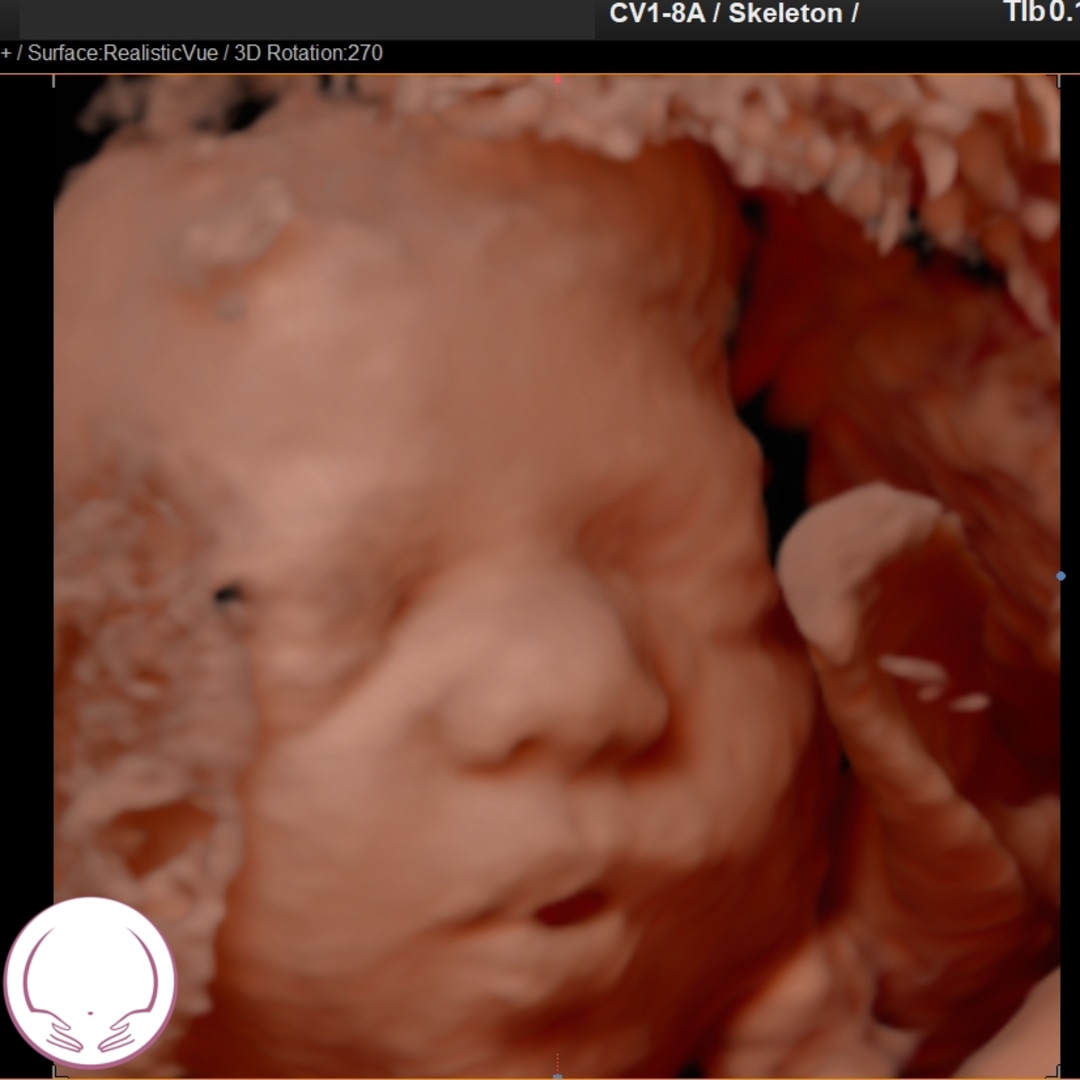 Photo shared by Alex for their Babylist baby registry.