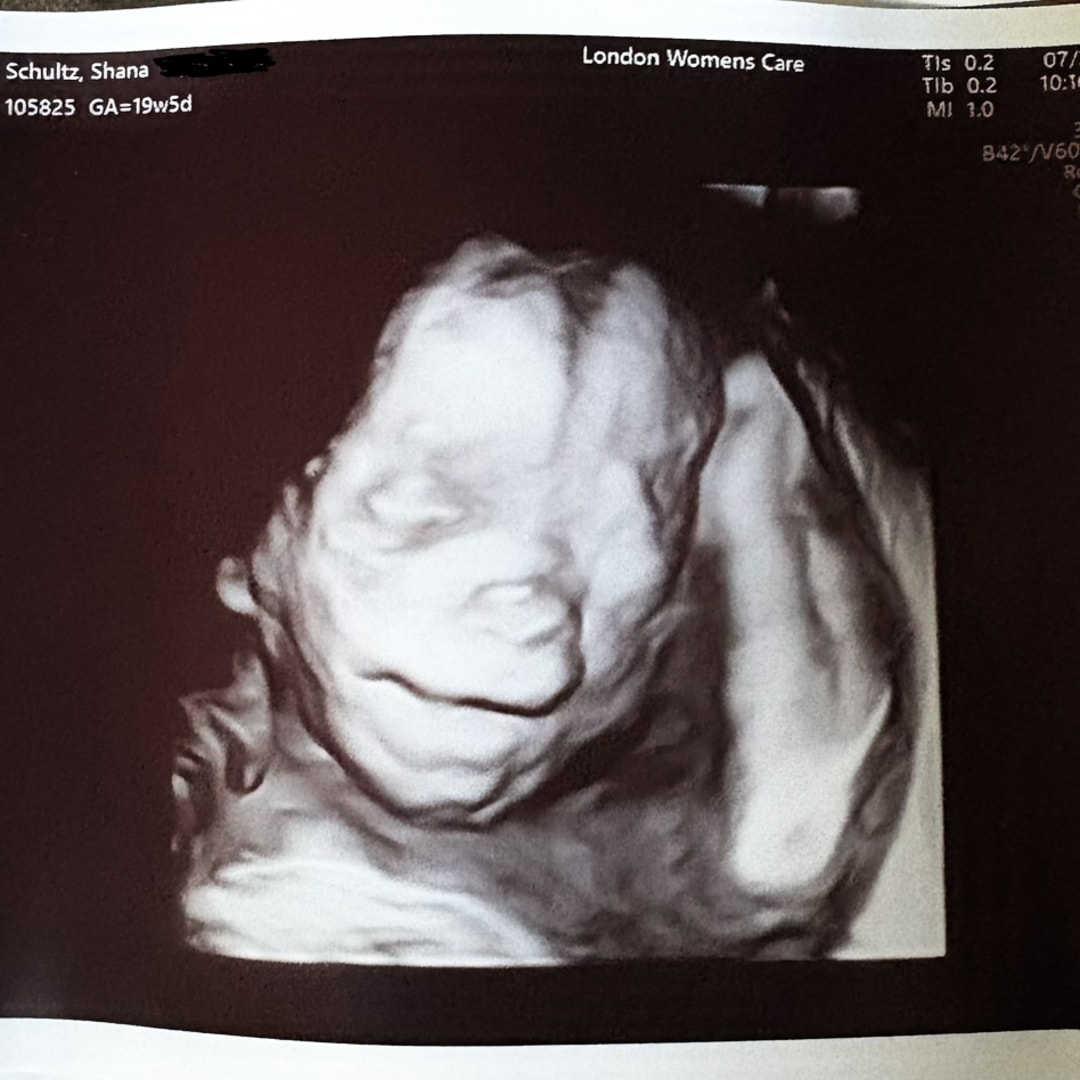 Photo shared by Shana for their Babylist baby registry.