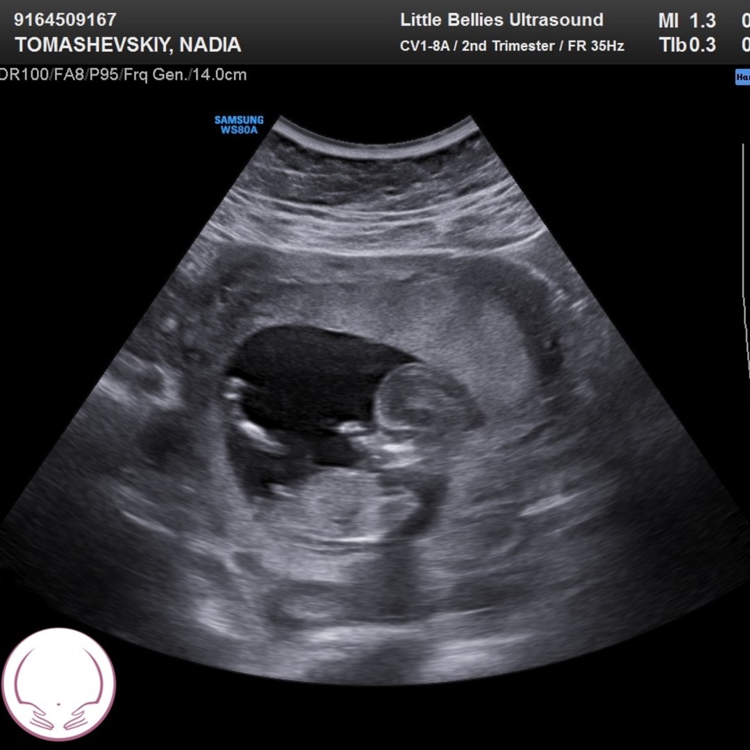 Photo shared by Nadia for their Babylist baby registry.