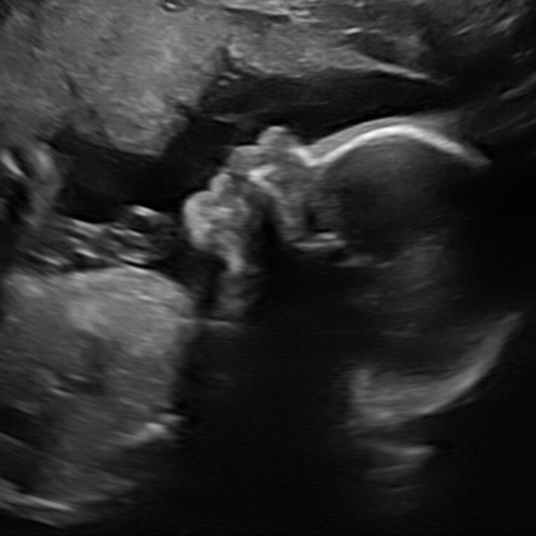 Photo shared by Leah for their Babylist baby registry.