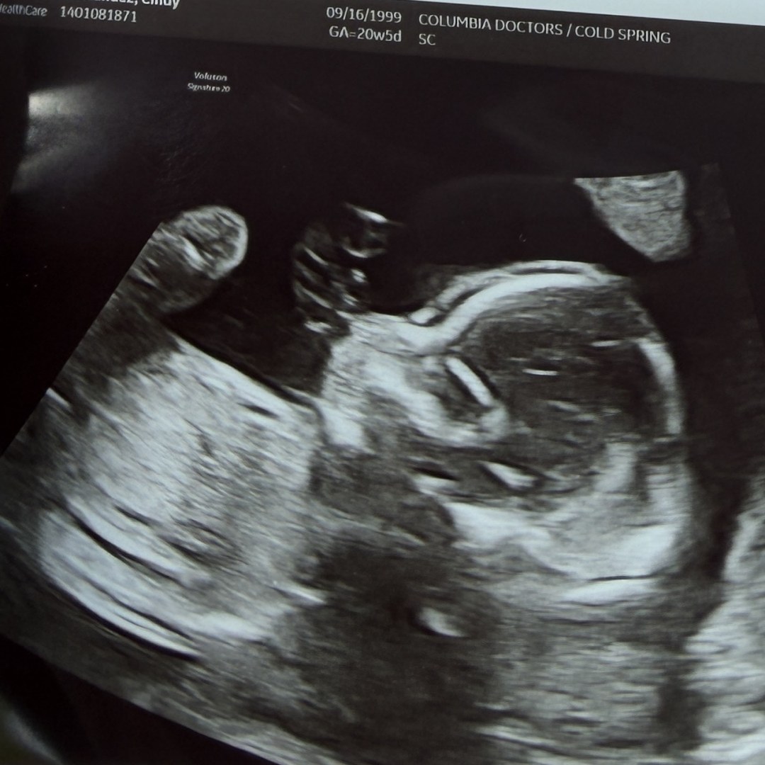 Photo shared by Cindy for their Babylist baby registry.