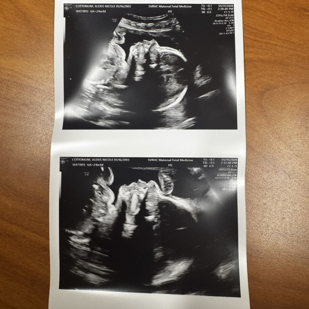 Photo shared by Alexis for their Babylist baby registry.